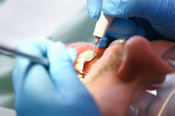 Best Emergency Treatment for Oral Infections in Ara, AL