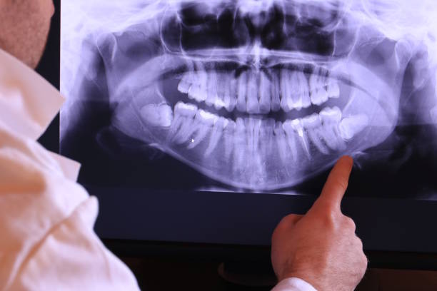 Best Knocked-Out Tooth (Avulsed Tooth) Treatment in Ara, AL